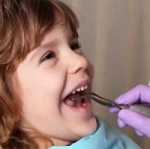 آزمون‌های سنجش فعالیت پوسید‌گی/اقد‌امات تشخیصی و پیشگیرانه کنترل پوسید‌گی دندان